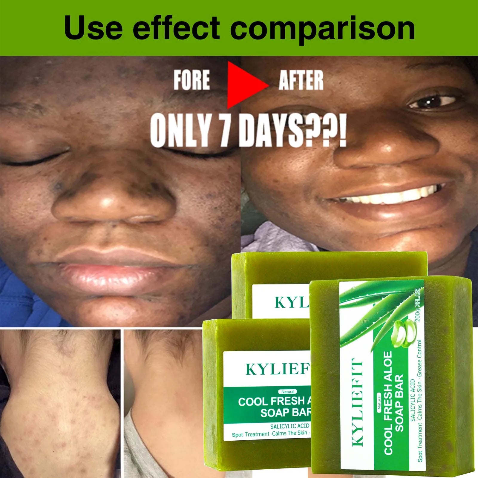 AILKE Aloe Vera Whitening Soap – Brightening & Acne Care