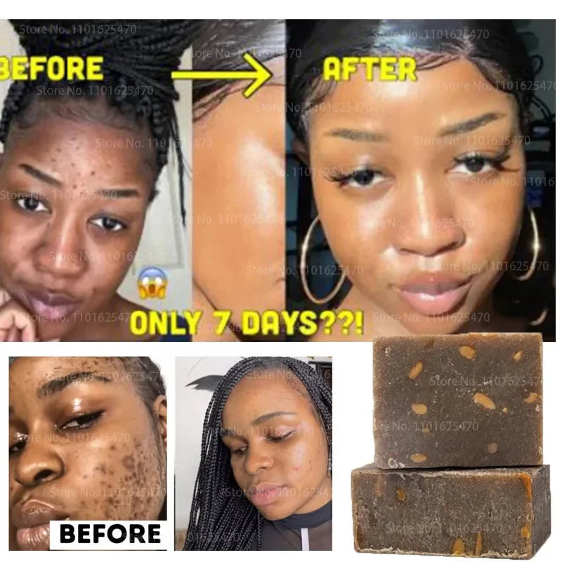 African Black Soap – Natural, Moisturizing & Anti-Aging Care